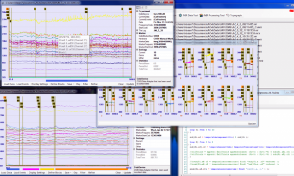 fnirsoft-standard-edition-e1444457075895